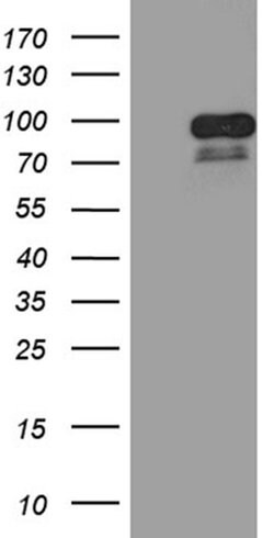 CCDC27 Monoclonal Antibody (OTI9C6), TrueMAB , OriGene 30 &mu;L | Buy Online | Origene Technologies | Fisher Scientific