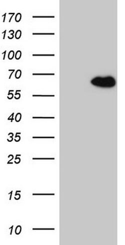 CCDC36 Monoclonal Antibody (OTI2D11), TrueMAB , OriGene 30 &mu;L | Buy Online | Origene Technologies | Fisher Scientific