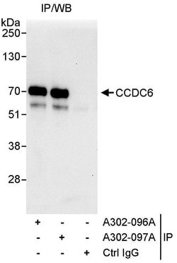 CCDC6 Rabbit anti-Human, Polyclonal, Bethyl Laboratories 100 &mu;l; Unlabeled:Antibodies,