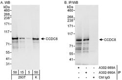 CCDC8 Rabbit anti-Human, Polyclonal, Bethyl Laboratories 100 &mu;L | Buy Online | Bethyl Laboratories, Inc | Fisher Scientific