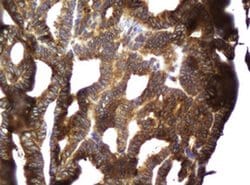 CCDC93 Monoclonal Antibody (OTI6E11), TrueMAB , OriGene 30 &mu;L; Unconjugated:Anticuerpos