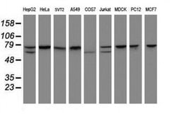 CCDC93 Monoclonal Antibody (OTI2A4), TrueMAB , OriGene 100 &mu;L; Unconjugated:Antibodies,