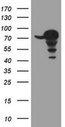 CCDC93 Monoclonal Antibody (OTI2D2), TrueMAB , OriGene:Antibodies:Primary