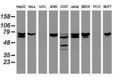 CCDC93 Monoclonal Antibody (OTI6E11), TrueMAB , OriGene 30 &mu;L; Unconjugated:Anticuerpos