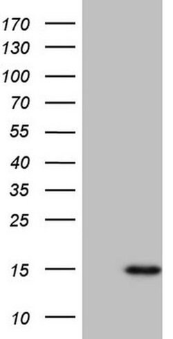 CCL5 Monoclonal Antibody (OTI2A7), TrueMAB , OriGene:Antibodies:Primary