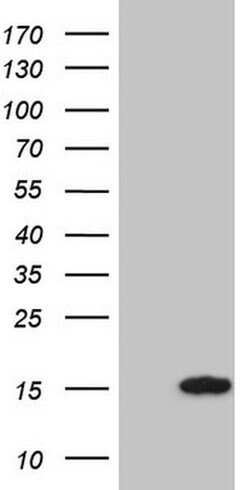 CCL5 Monoclonal Antibody (OTI10G5), TrueMAB , OriGene 30 &mu;L; Unconjugated:Antibodies,