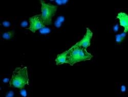 CCM2 Monoclonal Antibody (OTI2F9), TrueMAB , OriGene 100 &mu;L; Unconjugated:Antibodies,