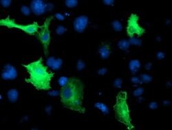 CCM2 Monoclonal Antibody (OTI1B9), TrueMAB , OriGene 100 &mu;L; Unconjugated:Antibodies,