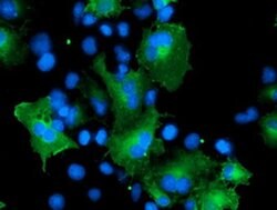 CCM2 Monoclonal Antibody (OTI5H4), TrueMAB , OriGene 100 &mu;L; Unconjugated:Antibodies,
