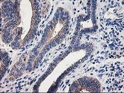 CCM2 Monoclonal Antibody (OTI2F9), TrueMAB , OriGene 100 &mu;L; Unconjugated:Antibodies,
