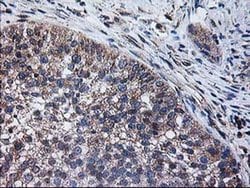 CCM2 Monoclonal Antibody (OTI2F9), TrueMAB , OriGene 100 &mu;L; Unconjugated:Antibodies,