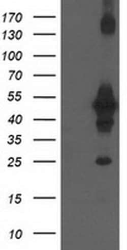 CCM2 Monoclonal Antibody (OTI1E8), TrueMAB , OriGene 30 &mu;L; Unconjugated:Antibodies,