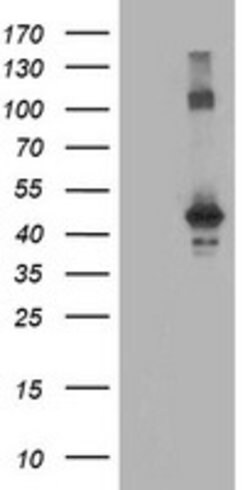CCM2 Mouse anti-Human, Clone: OTI2F9, lyophilized, TrueMAB 100 &mu;g | Buy Online | Origene Technologies | Fisher Scientific
