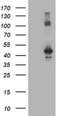 CCM2 Monoclonal Antibody (OTI2F9), TrueMAB , OriGene 100 &mu;L; Unconjugated:Antibodies,