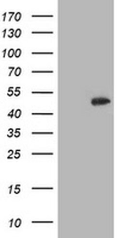 CCM2 Mouse anti-Human, Clone: OTI2E4, liquid, TrueMAB 100 &mu;L; Unconjugated:Antibodies,