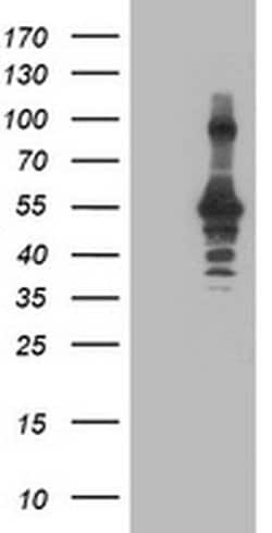 CCM2 Monoclonal Antibody (OTI1D1), TrueMAB , OriGene 30 &mu;L; Unconjugated:Antibodies,