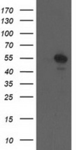 CCM2 Mouse anti-Human, Clone: OTI1B9, lyophilized, TrueMAB 100 &mu;g; Unconjugated:Antibodies,