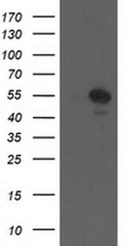 CCM2 Monoclonal Antibody (OTI1B9), TrueMAB , OriGene 100 &mu;L; Unconjugated:Antibodies,