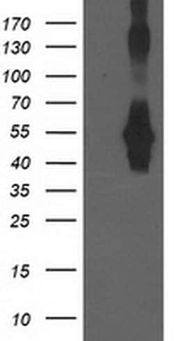 CCM2 Monoclonal Antibody (OTI5H4), TrueMAB , OriGene 100 &mu;L; Unconjugated:Antibodies,
