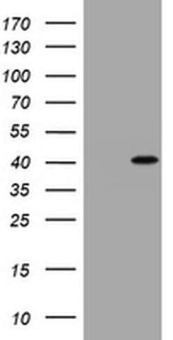 CCND1 Monoclonal Antibody (OTI1G2), TrueMAB , OriGene:Anticuerpos:Anticuerpos