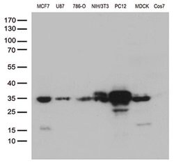 CCND1 Monoclonal Antibody (OTI1G2), TrueMAB , OriGene:Anticuerpos:Anticuerpos