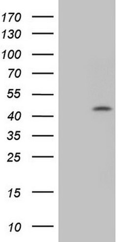 CCND1 Monoclonal Antibody (OTI1G8), TrueMAB , OriGene:Antibodies:Primary