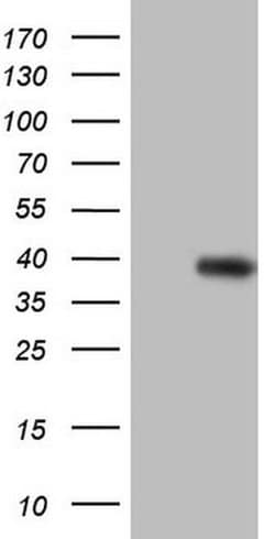 CCND2 Monoclonal Antibody (OTI2D6), TrueMAB , OriGene 100 &mu;L; Unconjugated:Antibodies,