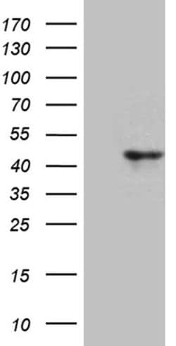 CCNI Monoclonal Antibody (OTI3F10), TrueMAB , OriGene 100 &mu;L; Unconjugated:Antibodies,