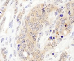 CCT3 Rabbit anti-Human, Mouse, Polyclonal, Bethyl Laboratories 100 &mu;L;