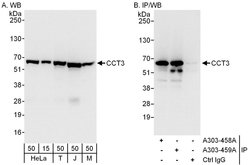 CCT3 Rabbit anti-Human, Mouse, Polyclonal, Bethyl Laboratories 100 &mu;L;