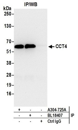 CCT4 Rabbit anti-Human, Mouse, Polyclonal, Bethyl Laboratories 100 &mu;L | Buy Online | Bethyl Laboratories, Inc | Fisher Scientific