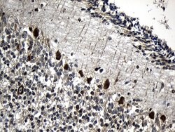 CCT4 Mouse anti-Human, Clone: OTI4E6, lyophilized, TrueMAB 100 μg; Unconjugated:Antibodies,