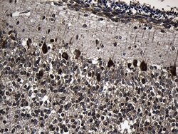 CCT4 Monoclonal Antibody (OTI4C9), TrueMAB , OriGene 100 &mu;L | Buy Online | Origene Technologies | Fisher Scientific