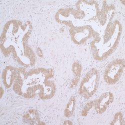 CCT7 Rabbit anti-Human, Polyclonal, Bethyl Laboratories 100 &mu;L; Unconjugated:Antibodies,