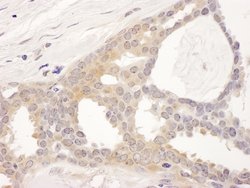 CCT8 Rabbit anti-Human, Mouse, Polyclonal, Bethyl Laboratories 100 &mu;L;