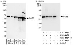 CCT8 Rabbit anti-Human, Mouse, Polyclonal, Bethyl Laboratories 100 &mu;L;