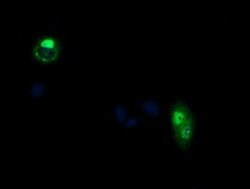 CCT8L2 Monoclonal Antibody (OTI1F7), TrueMAB , OriGene 100 &mu;L; Unconjugated:Antibodies,
