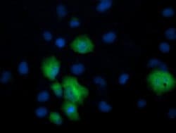 CCT8L2 Monoclonal Antibody (OTI1F5), TrueMAB , OriGene:Antibodies:Primary