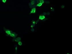 CCT8L2 Mouse anti-Human, Clone: OTI4B7, lyophilized, TrueMAB 100 &mu;g;
