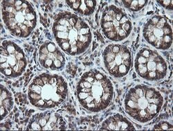 CCT8L2 Mouse anti-Human, Clone: OTI1C1, lyophilized, TrueMAB 100 &mu;g;