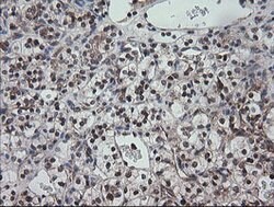 CCT8L2 Mouse anti-Human, Clone: OTI1C1, lyophilized, TrueMAB 100 &mu;g;