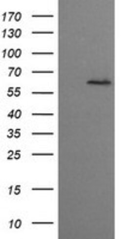 CCT8L2 Mouse anti-Human, Clone: OTI1C1, lyophilized, TrueMAB 100 &mu;g;