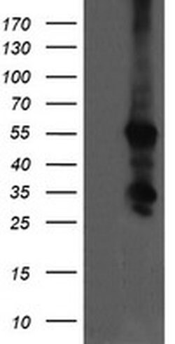 CCT8L2 Monoclonal Antibody (OTI4A4), TrueMAB , OriGene 30 &mu;L; Unconjugated:Antibodies,