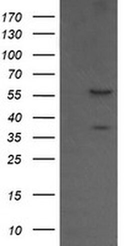CCT8L2 Monoclonal Antibody (OTI1F5), TrueMAB , OriGene 30 &mu;L; Unconjugated:Antibodies,