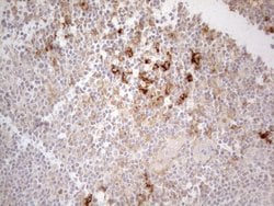 CD13 Monoclonal Antibody (OTI3F8), TrueMAB , OriGene 100 &mu;L; Unconjugated:Antibodies,