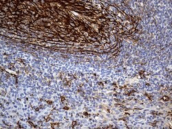 CD14 Monoclonal Antibody (OTI9C7), TrueMAB , OriGene:Antibodies:Primary