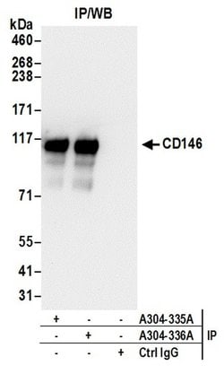 CD146 Rabbit anti-Human, Mouse, Polyclonal, Bethyl Laboratories 100 &mu;L;