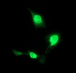 CD163 Mouse anti-Human, Clone: OTI1B4, liquid, TrueMAB 100 &mu;L; Unconjugated:Antibodies,