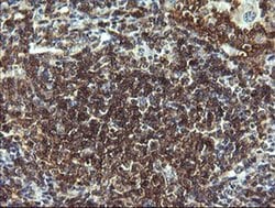 CD19 Monoclonal Antibody (OTI1F9), TrueMAB , OriGene:Antibodies:Primary