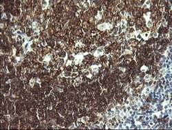 CD19 Monoclonal Antibody (OTI1F9), TrueMAB , OriGene 100 &mu;L; Unconjugated:Antibodies,